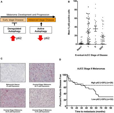 Prognostic Impact of Autophagy Biomarkers for Cutaneous Melanoma